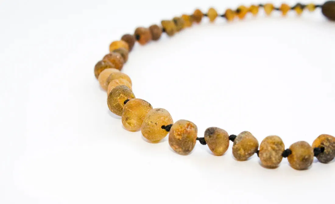 Healing Amber Necklace 11 Inches