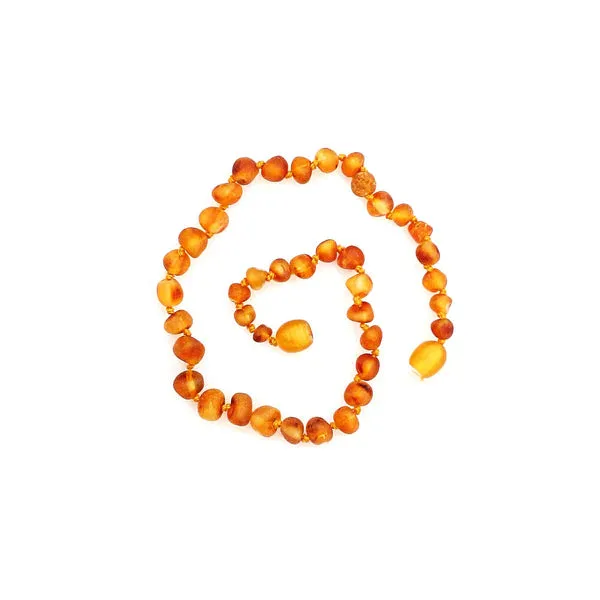 Healing Amber Necklace 11 Inches