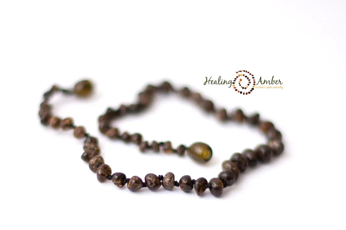 Healing Amber Necklace 11 Inches